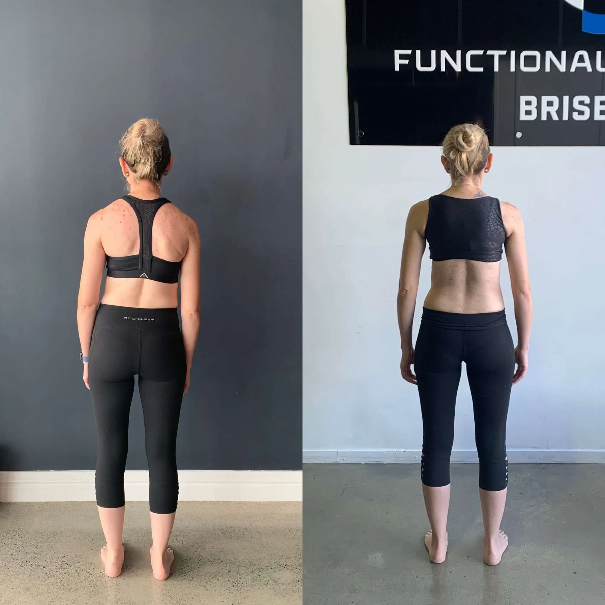 before and after