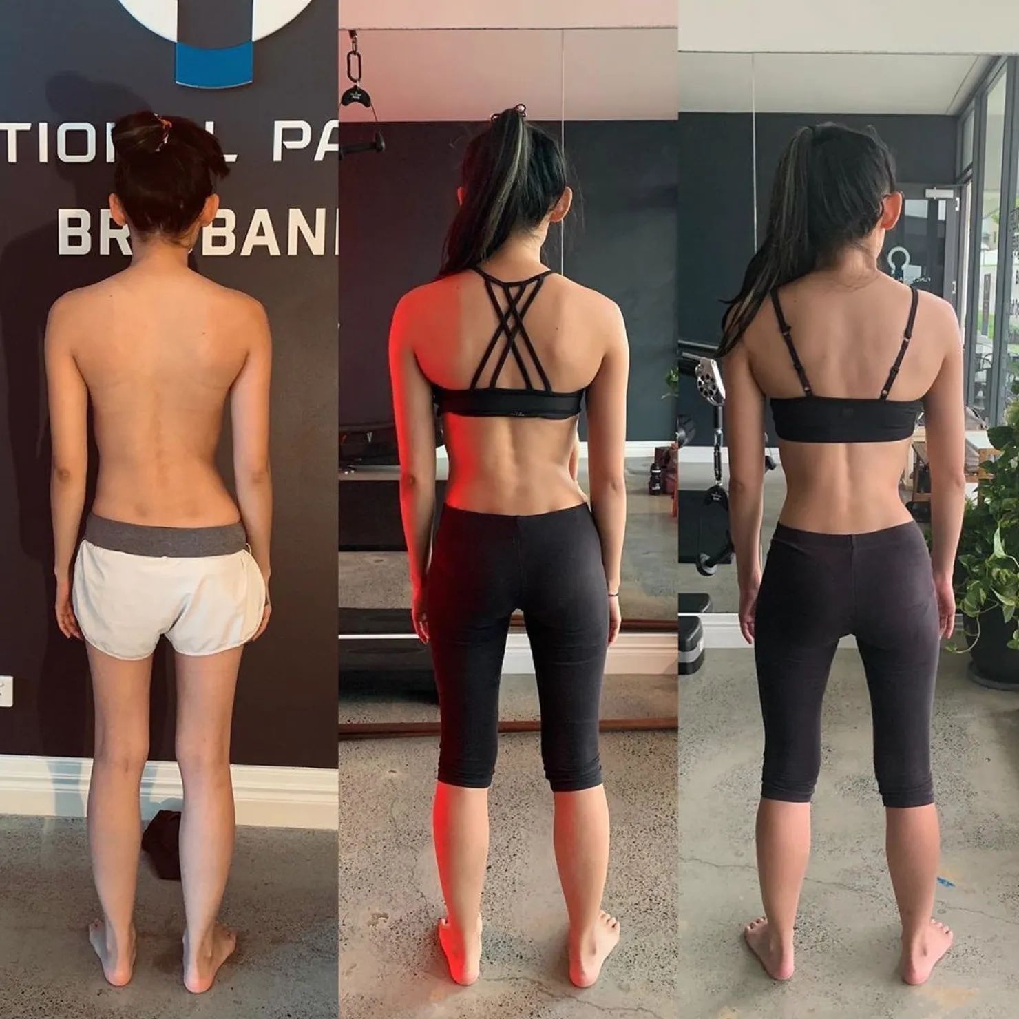 Melissa: before and after